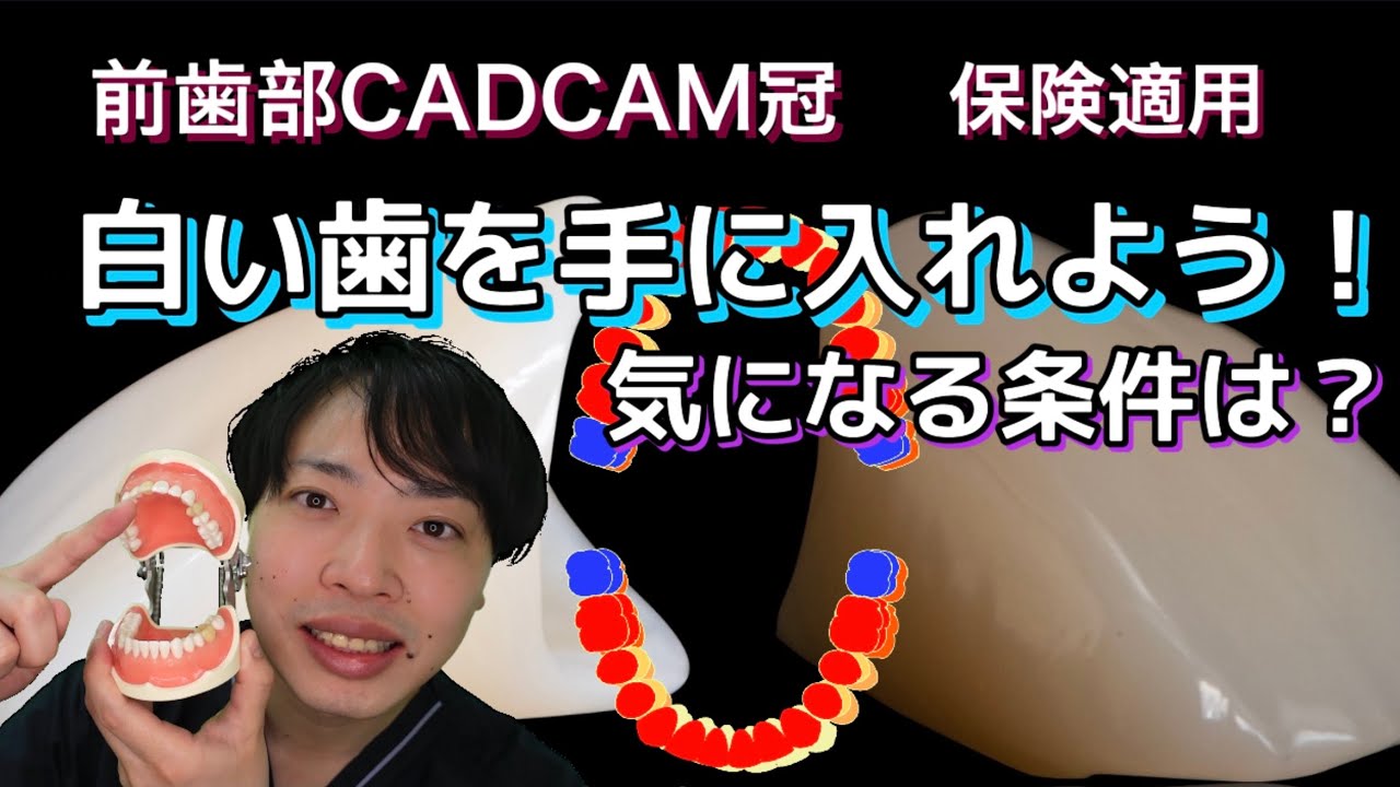 前歯にCAD/CAM冠　保険の白い歯ってどうなの？気になる条件（保険適用）を分かりやすく解説！