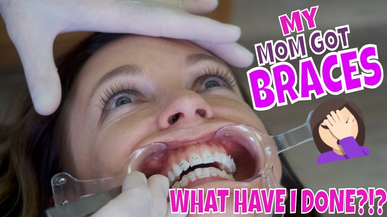 MY MOM GOT BRACES!?!