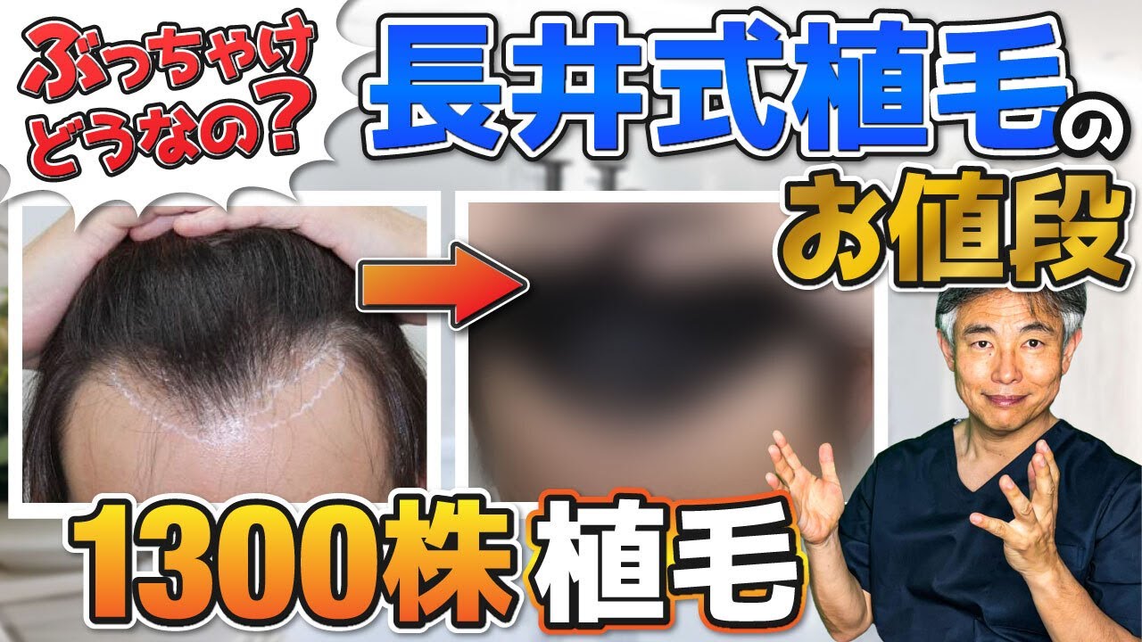 【YouTube初公開】～万円でできる！世界最高水準の長井式植毛のお値段①