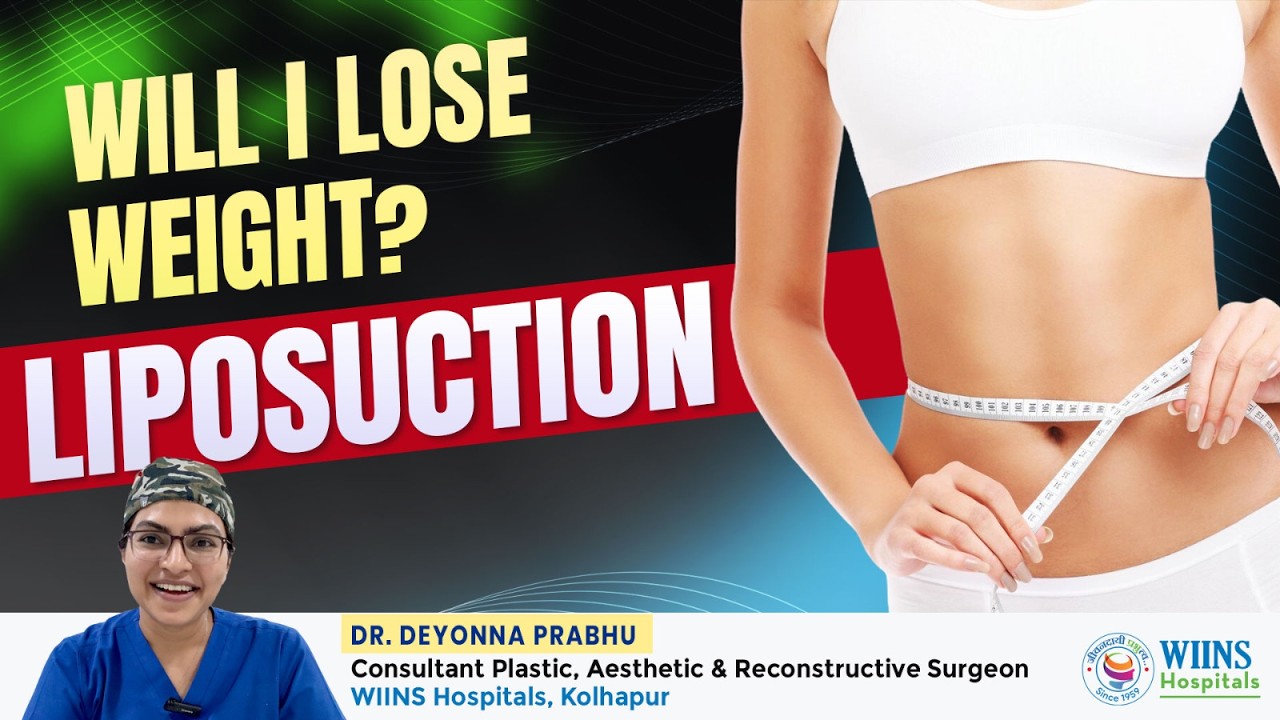 Will Liposuction Help You Lose Weight? The Truth Most Patients Don’t Know