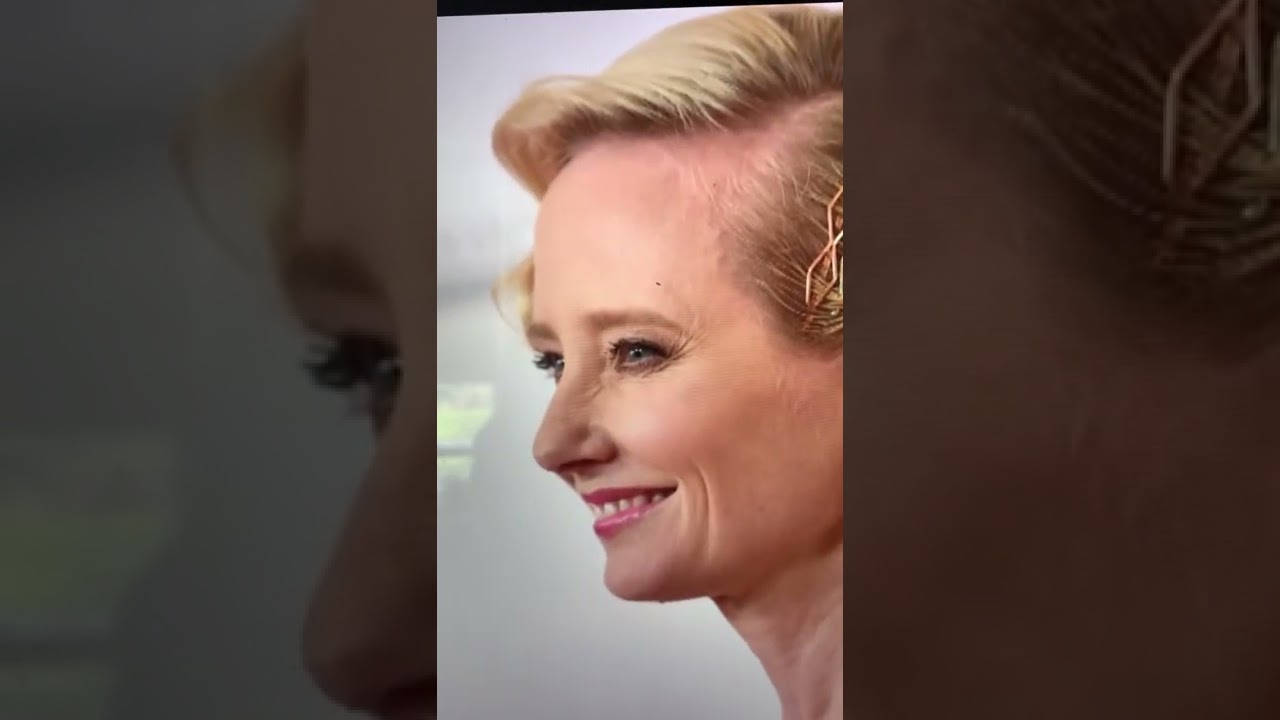 Anne Heche update is a sobering reminder. I will draw no conclusions, but this disturbs me.