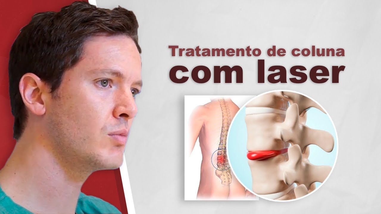 Hérnia de disco a Laser: Tratamento coluna com laser