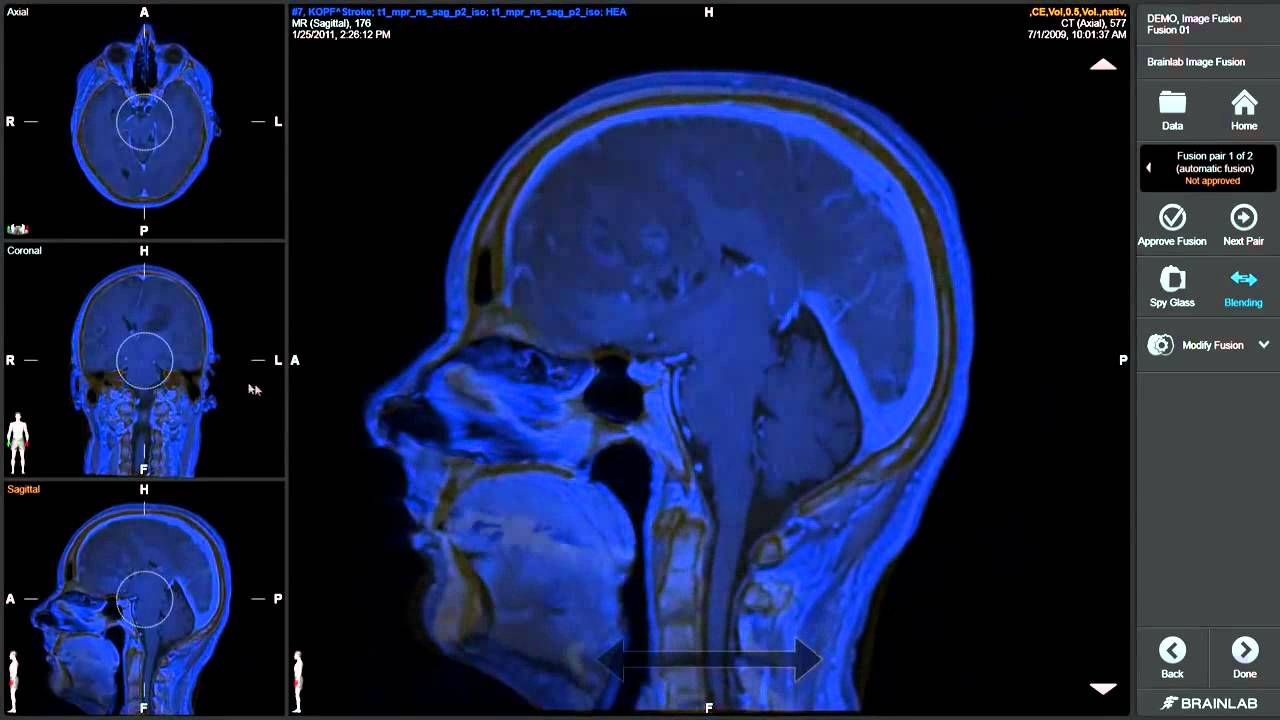 Intelligent Pre Calculated Image Fusion