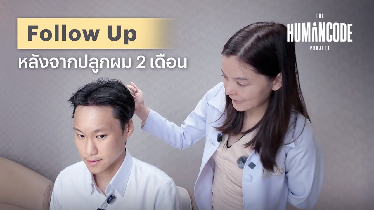 มาดูผลลัพธ์หลังปลูกผมครบ 2 เดือนกันครับ | The Humancode Project