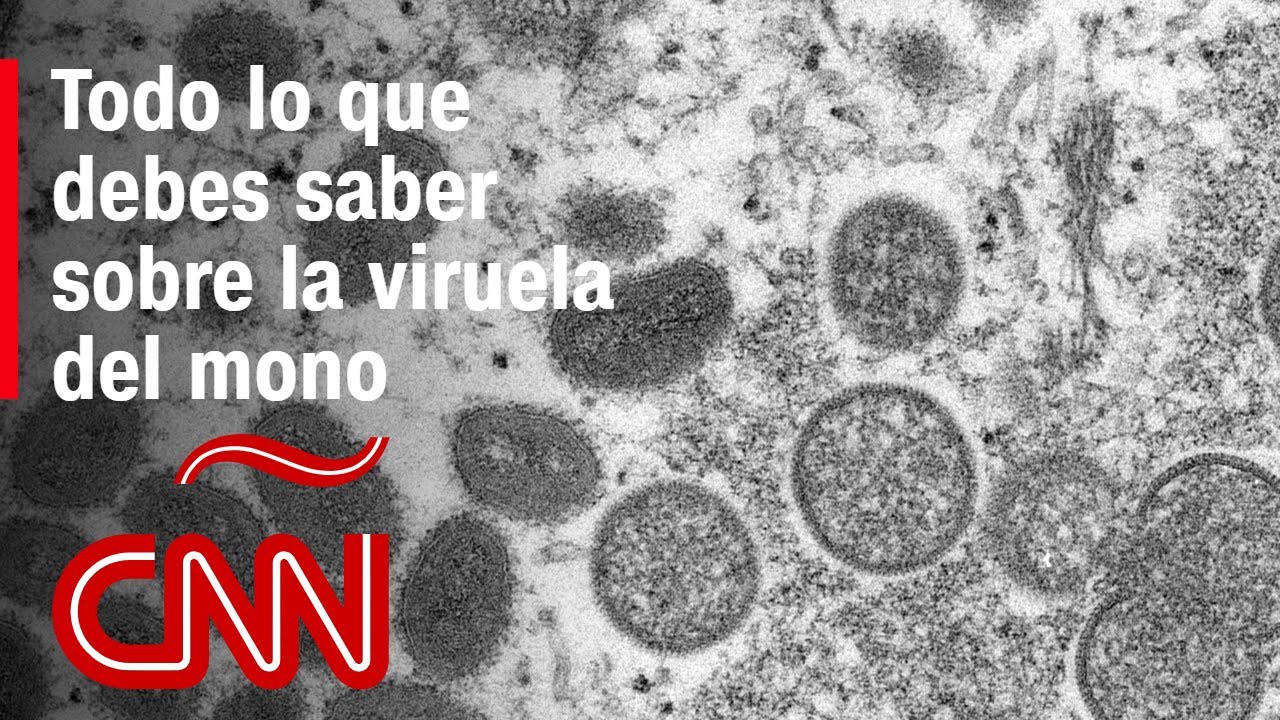 Viruela del mono: &iquest;c&oacute;mo se propaga, cu&aacute;les son sus s&iacute;ntomas y por qu&eacute; este brote es diferente?