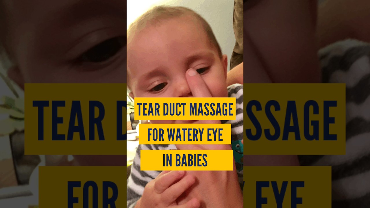 शिशु की आँखों से पानी आना ठीक करने का सही तरीका | | Tear Duct Massage