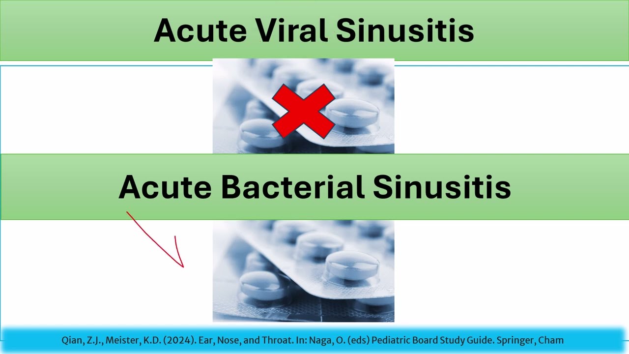 Viral vs. Bacterial Sinusitis in Children