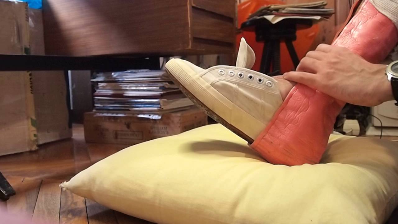 steccare un piede rotto (sam splint application broken foot)