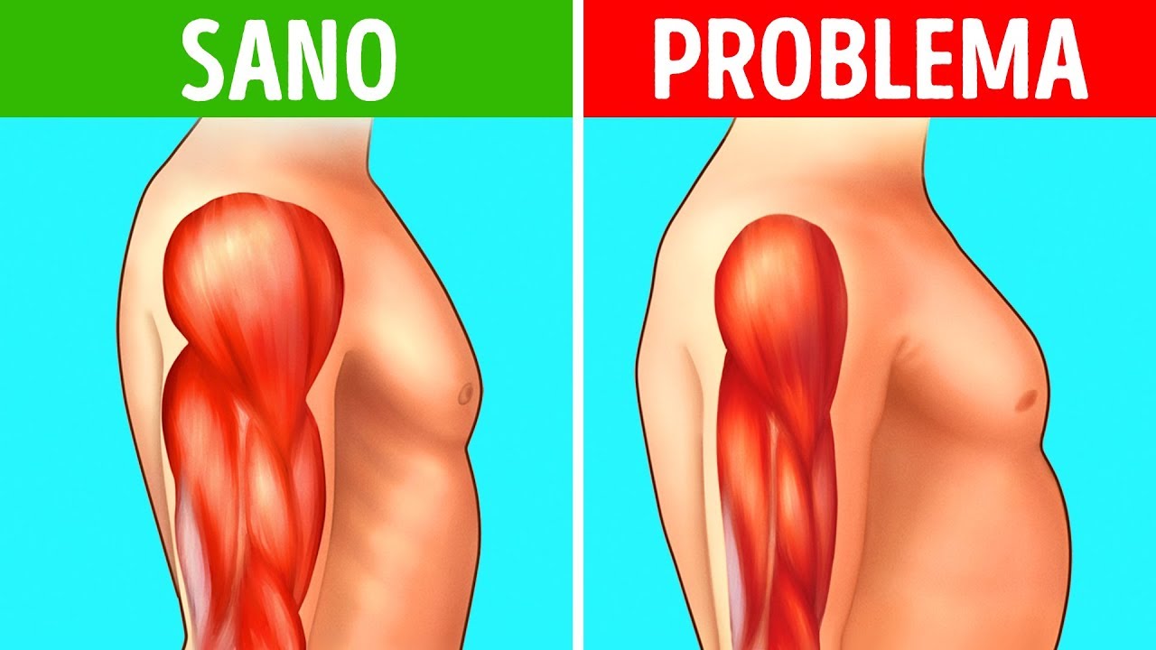 Degenerazione Muscolare: Non Ignorare Questi 8 Segni Precoci!