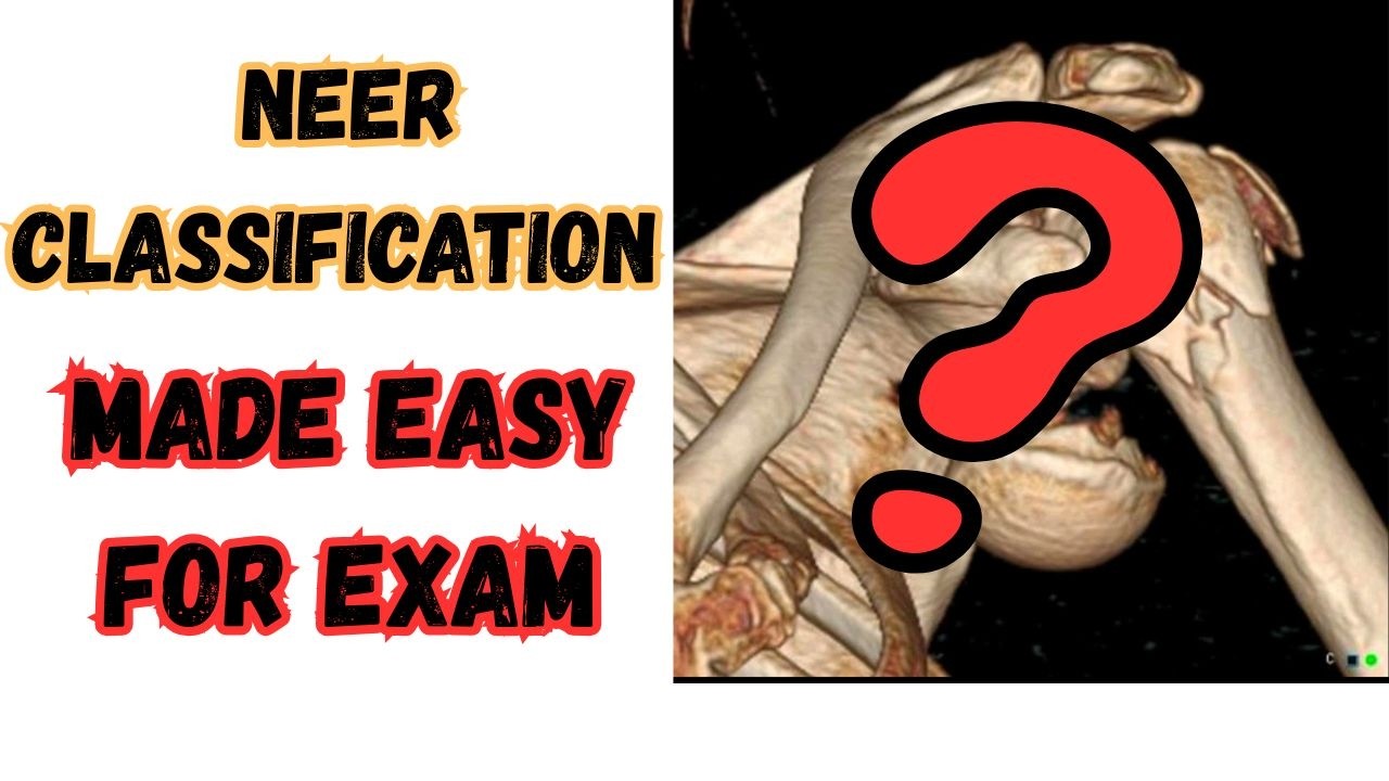 Neer classification of Proximal Humerus Fractures : Made EASY for EXAM