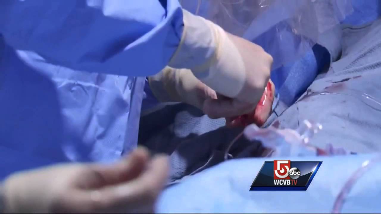 Heart attack mistaken for heartburn; Symptoms not same for all