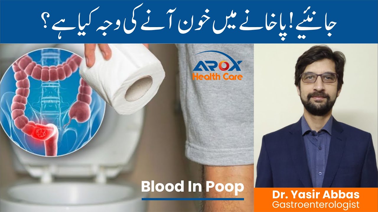 Blood In Poop - Series (Part-I) | پاخانے میں خون آنا | By Dr. Yasir Abbas | Urdu/Hindi