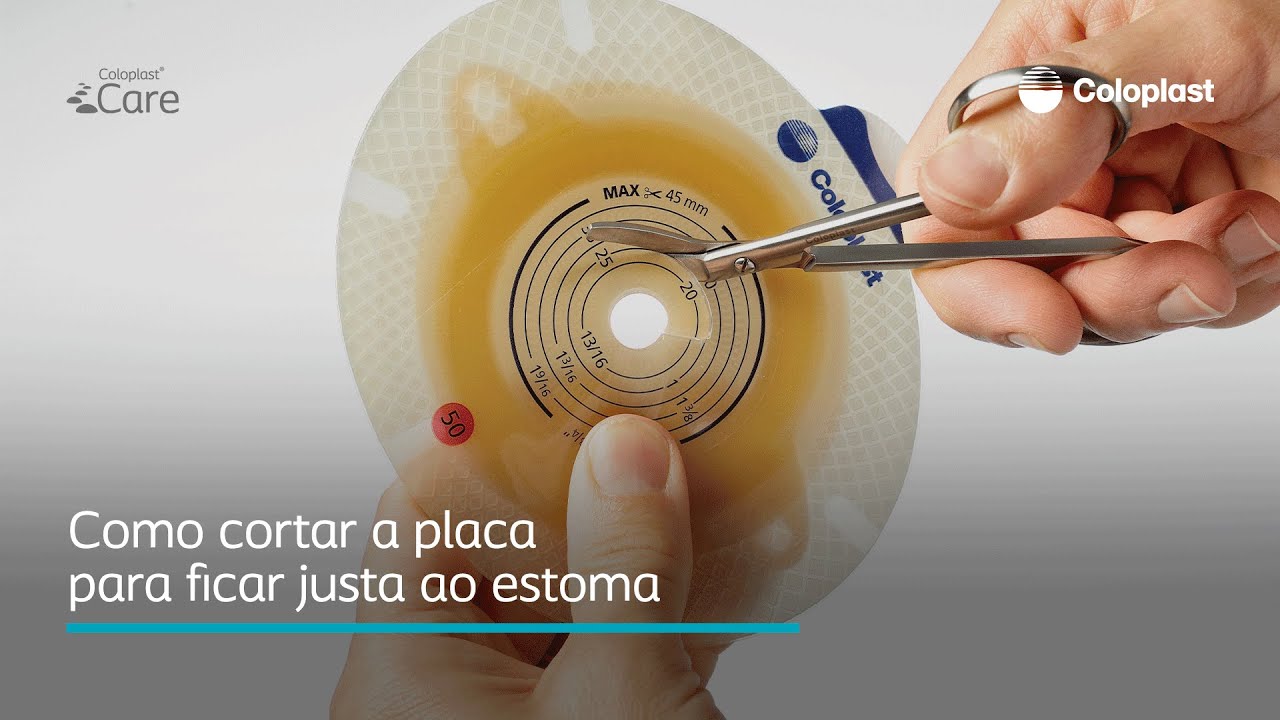Como cortar a placa para ficar justa ao estoma
