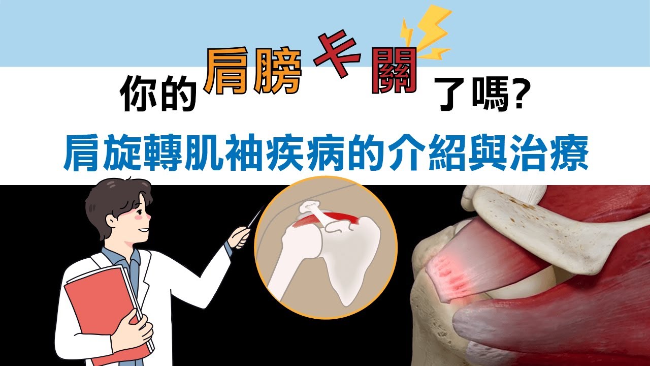 【衛教】你的肩膀卡關了嗎? 肩旋轉肌袖疾病的介紹與治療 (國語)