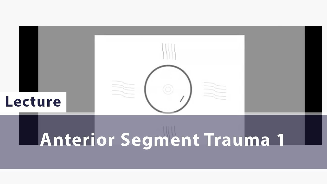 Anterior Segment Trauma 1