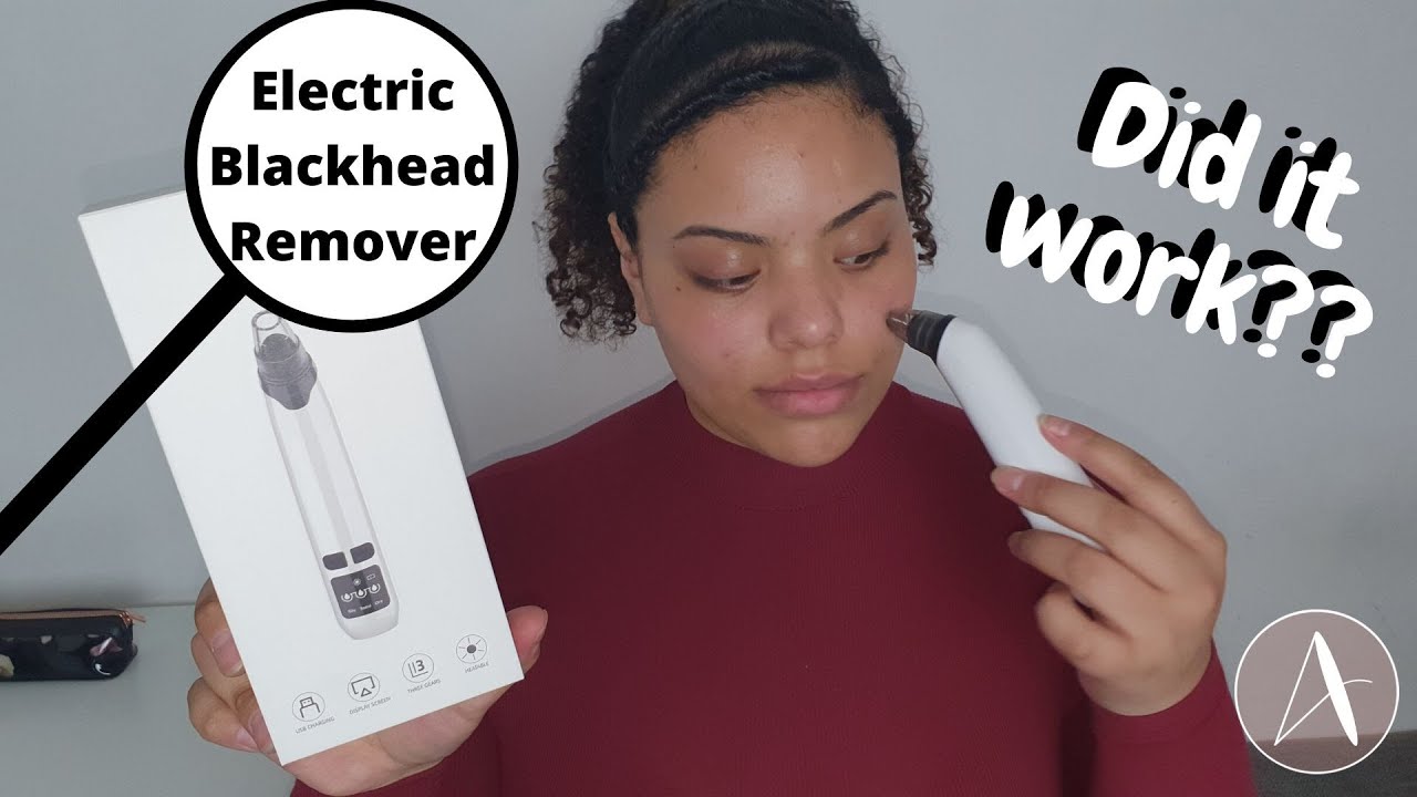 Electric Blackhead Remover | Does it really work?!?