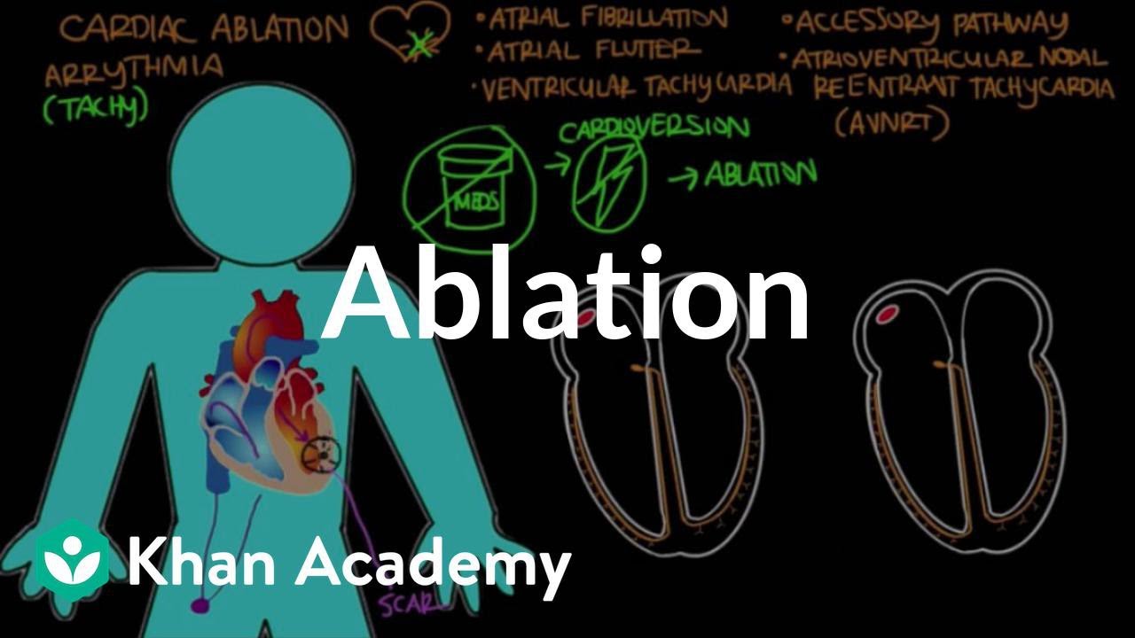 Ablation | Circulatory System and Disease | NCLEX-RN | Khan Academy