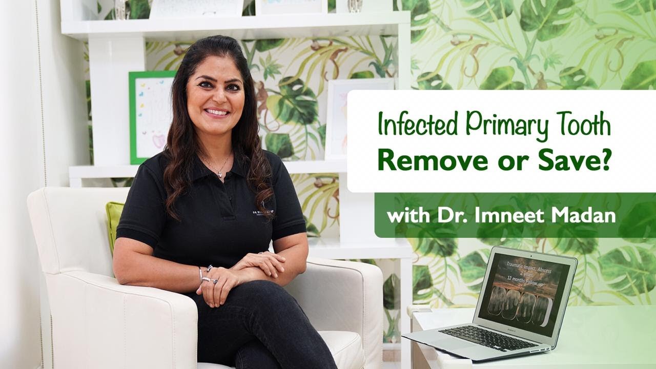 Infected Primary Tooth: Remove or Save?