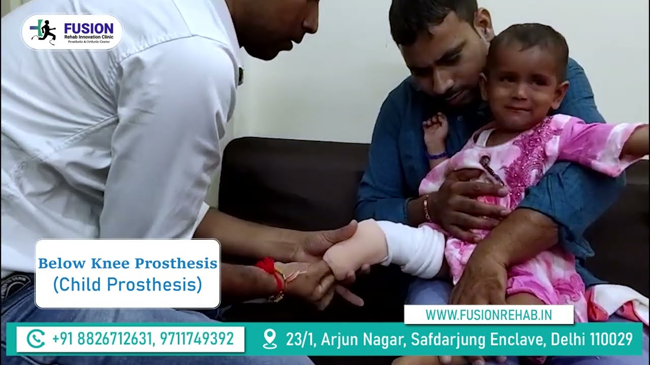 CHILD PROSTHESIS  || Artificial Leg // Leg Training // 
