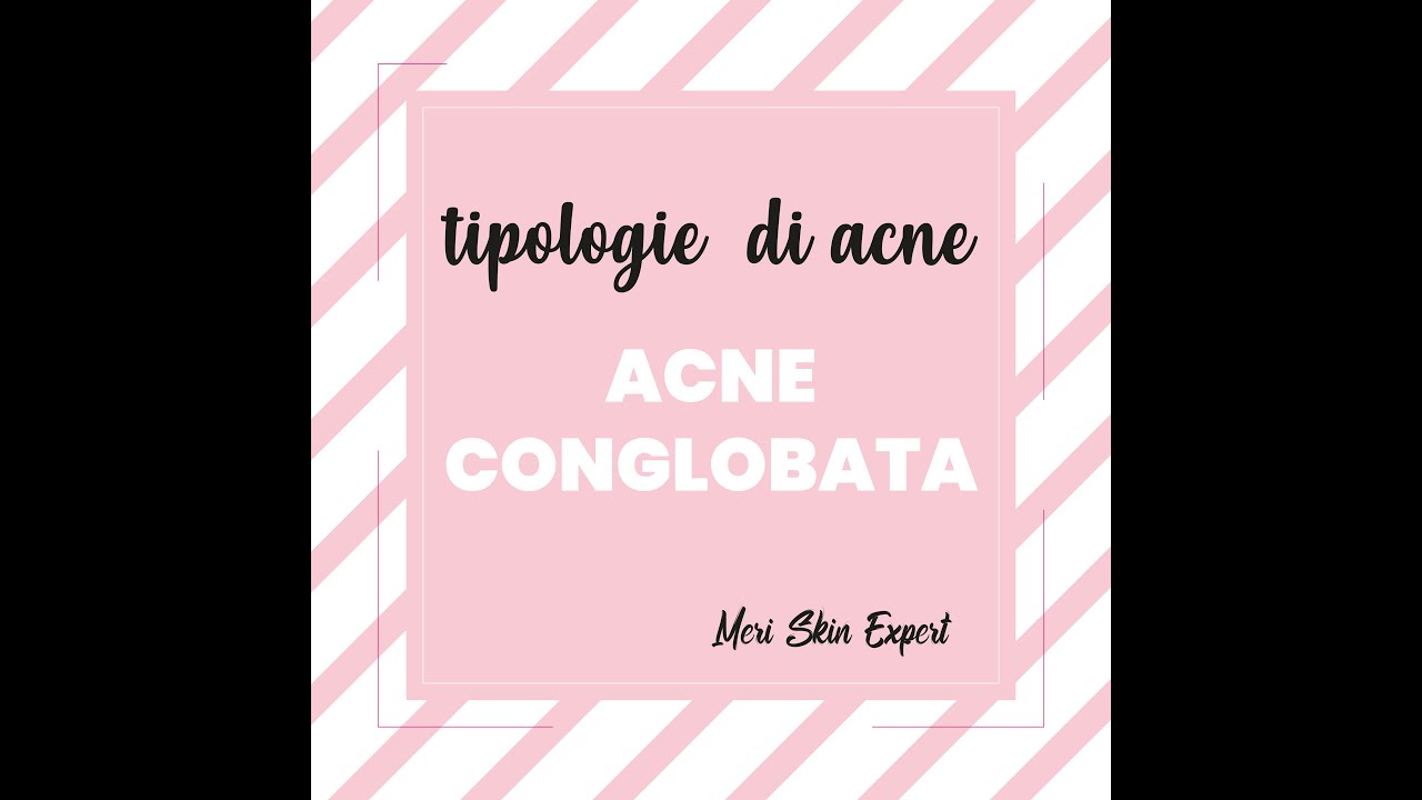 che cos'&egrave; l'acne conglobata | Meri Skin Expert | Viva Benessere Torino