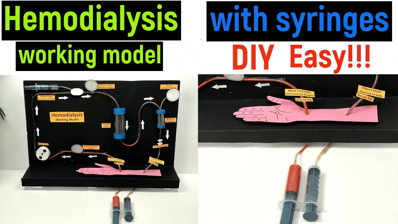 hemodialysis working model - hemodialysis working model with syringes - diyas funplay - diy project