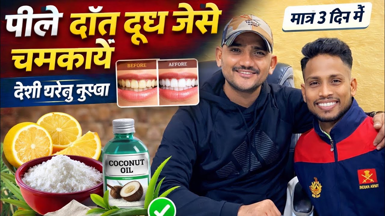 पीले दाँत दूध जैसे चमकायें ||मात्र 3 दिन मेँ ||देसी घरेलु नुस्खा ||@SUCCESSPHYSICALACADEMY86 