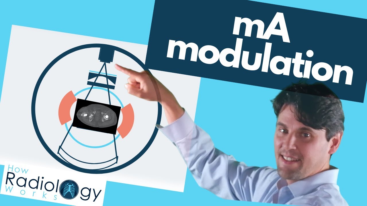 Tube Current Modulation (CT Physics)