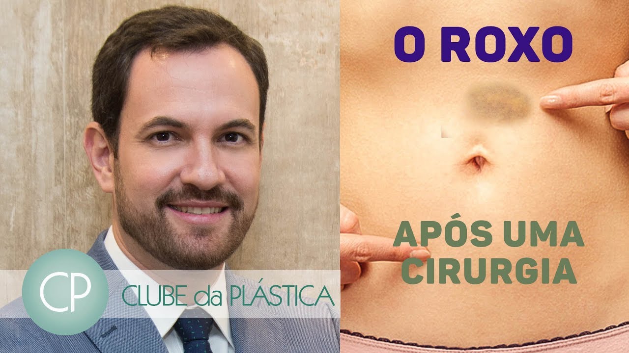 Clube da Plástica: O 
