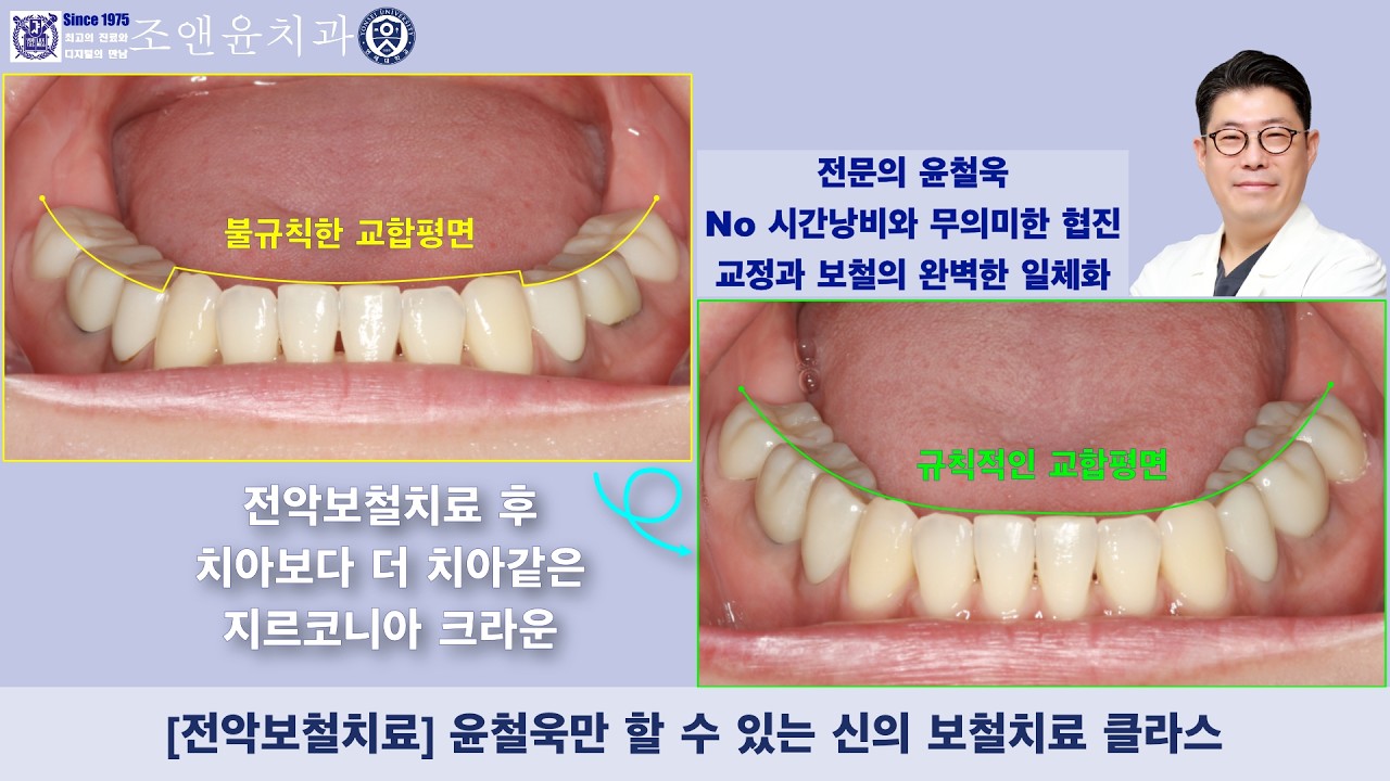 [내일남] 신의 보철치료 클라스 : 보철과전문의 사이의 실력은 하늘과 땅 차이이며, 일반적인 치과의사들과의 보철치료 퀄리티 격차는 가히 우주와 지구만큼의 압도적인 거리감을 가집니다