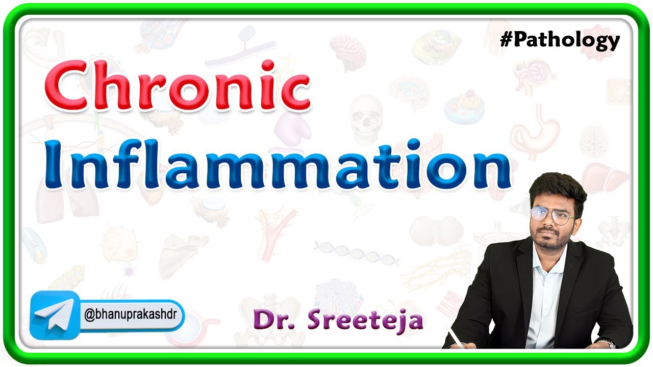 2. Chronic Inflammation : USMLE Step 1 Pathology