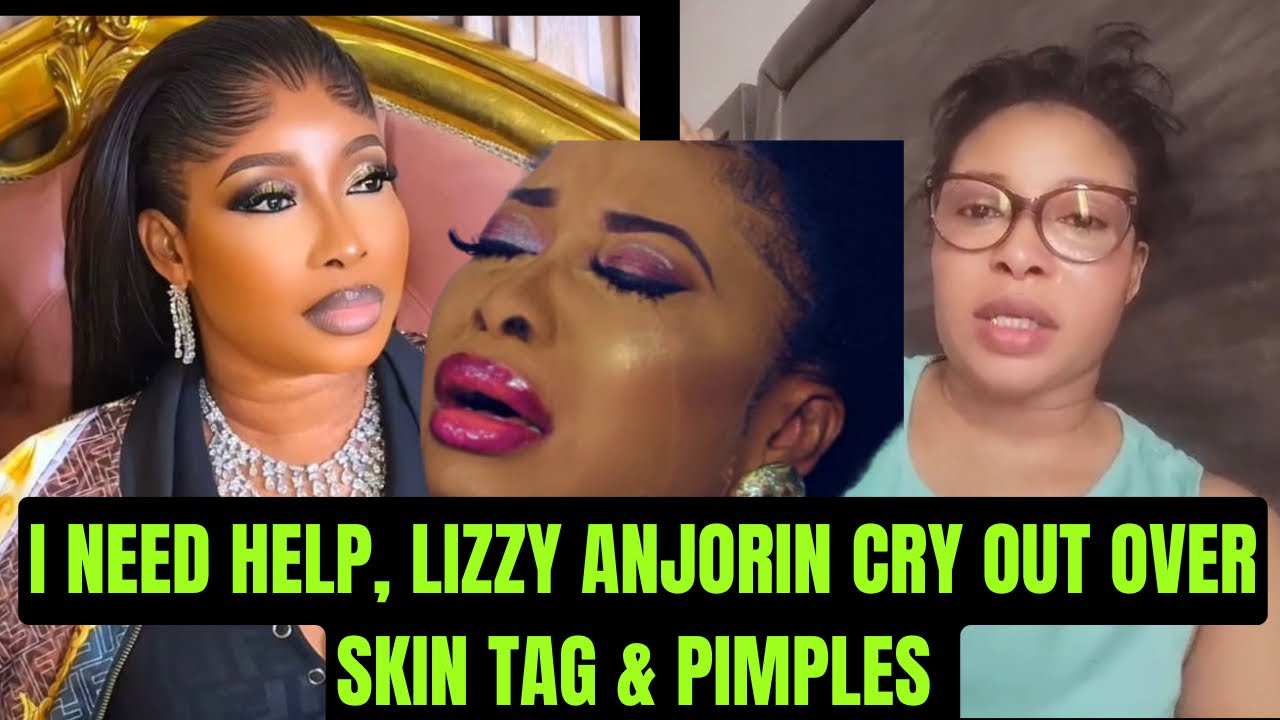 I NEED HELP 😭 LIZZY ANJORIN CRY OUt OVER SKIN TAGS AND PIMPLES | Yoruba Movie 2026 Drama 