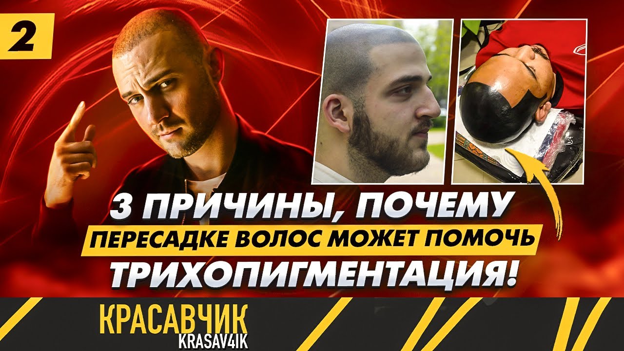 Три способа вернуть волосы | SMP или трихопигментация / KRASAV4IK