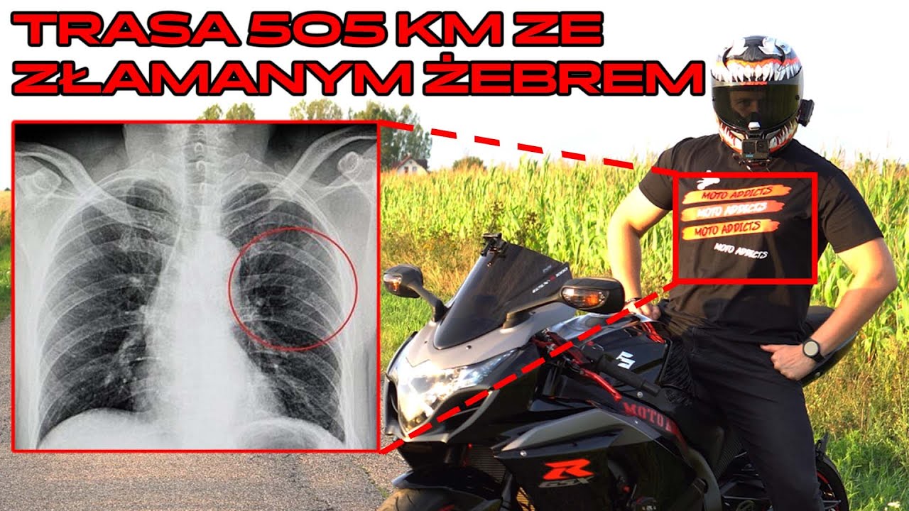 Trasa na moto ze złamanym żebrem! Albo 300 albo wcale! | Moto vlog Moto Addicts