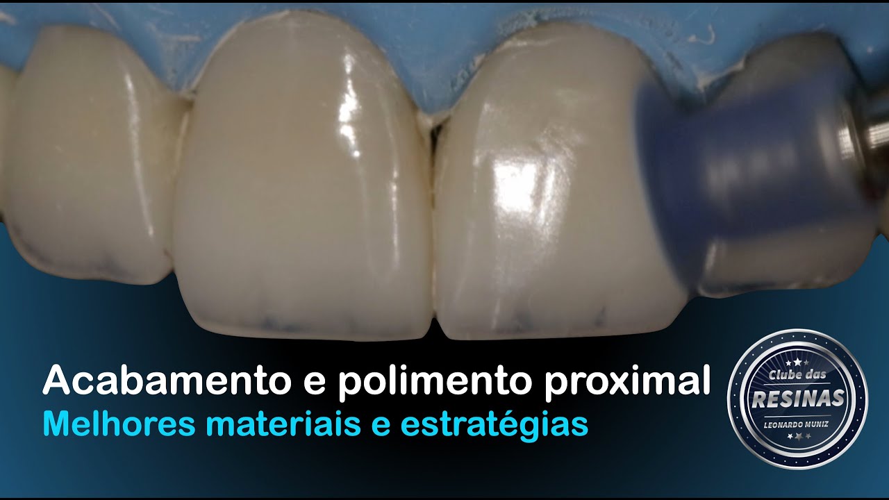 Acabamento e polimento proximal - Melhores materiais e estratégias
