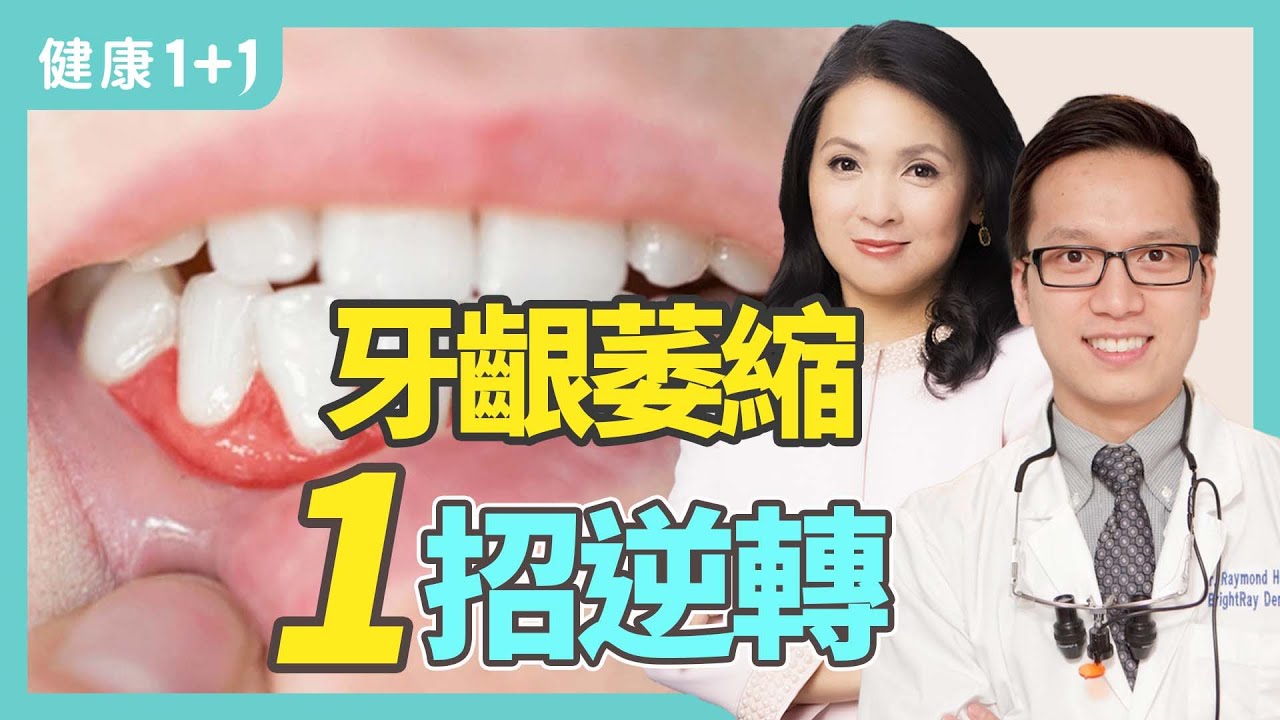 洗牙後牙齒變白是因爲？洗牙清除牙結石才使牙縫變大；洗牙會不會傷害牙齒？牙科醫師建議定期洗牙 | 健康1+1 · 小影片