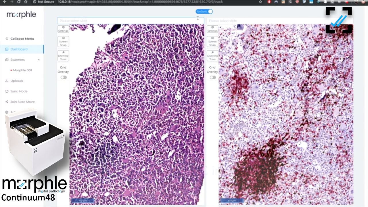 Affordable Digital Pathology | Morphle Continuum 48 Whole Slide Scanner demo  with 40X objective