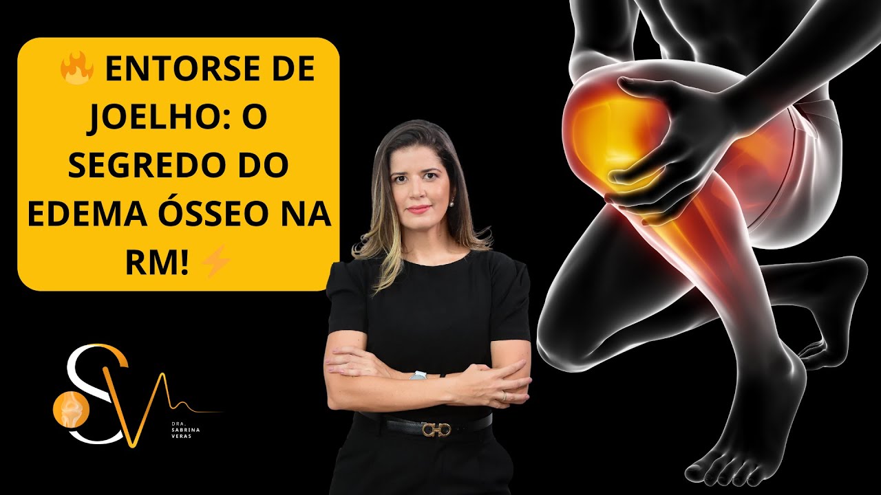 🔥 ENTORSE DE JOELHO: O SEGREDO DO EDEMA ÓSSEO NA RM!  AULA 1