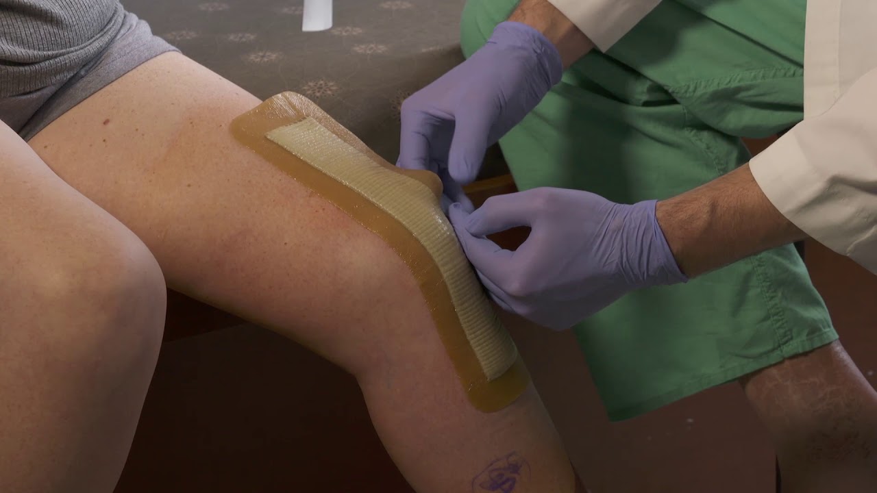 AQUACEL® Ag Surgical Application in Office with Dr. Bryan Springer