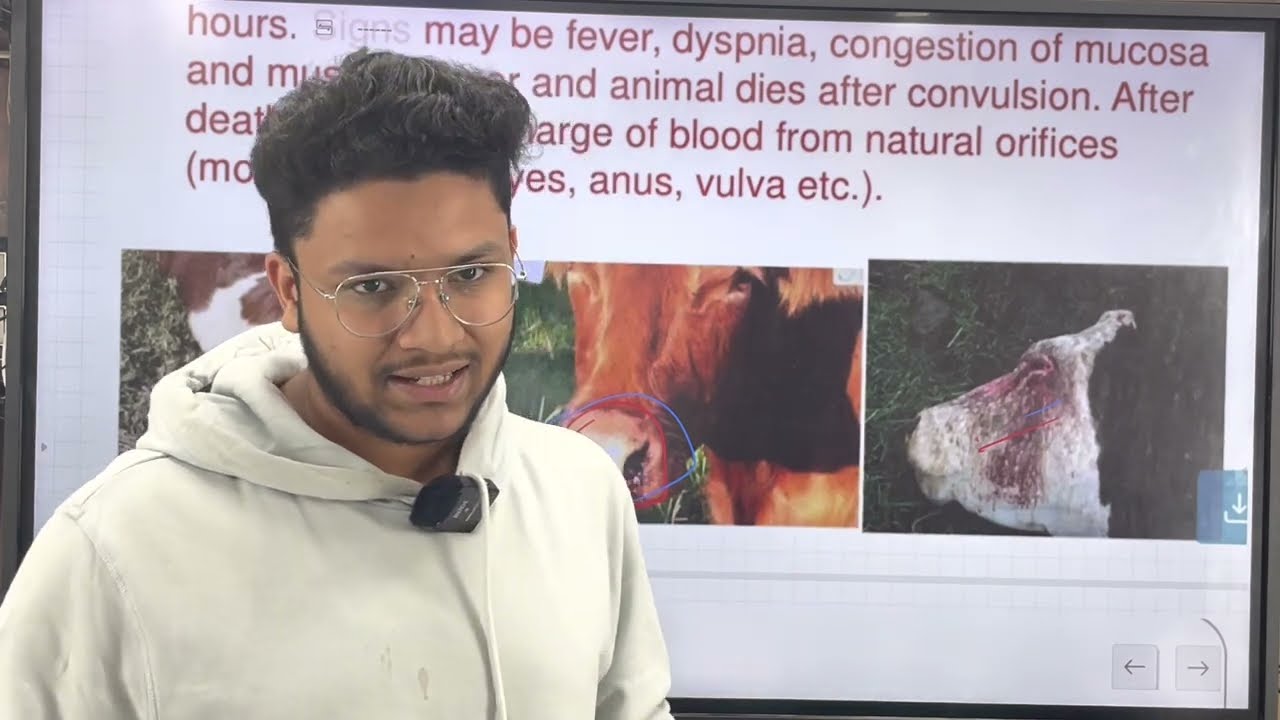 Anthrax | Clinical and Theoretical Aspects | Saad Khan