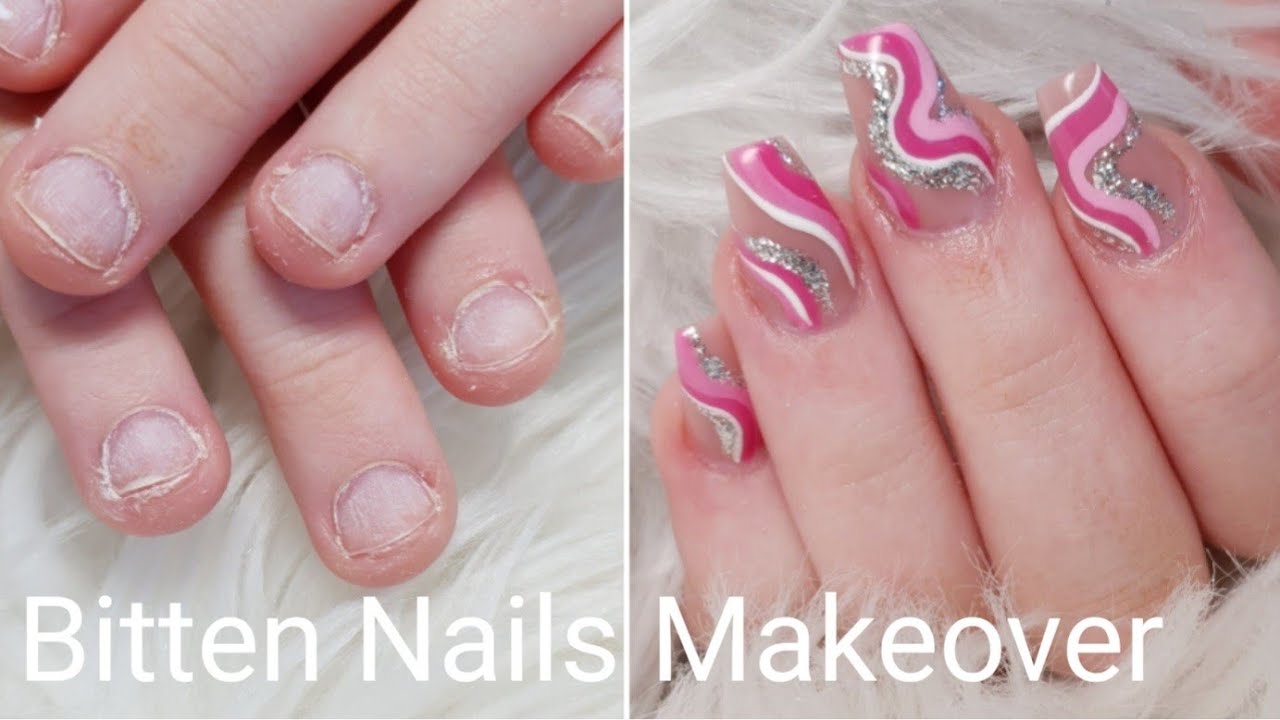 Bitten Nails Makeover. Gel extensions on Bitten nails.