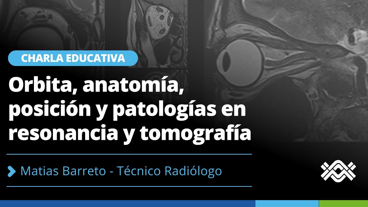 👁️ Órbita: anatomía, posicionamiento y patologías en RMN y TAC | Ciclo de Charlas Multidiagnóstico