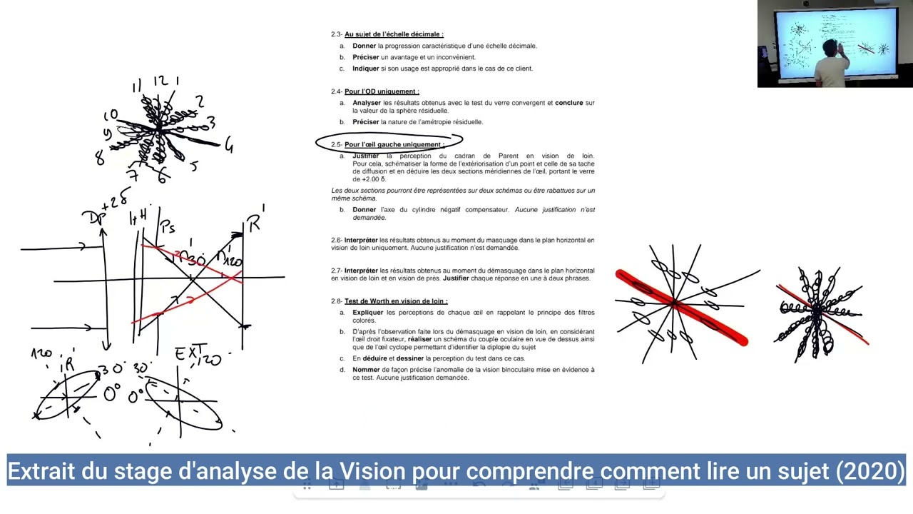 Stages Analyse de la Vision BTS Opticien Lunetier Sujet 2020 comment lire u sujet