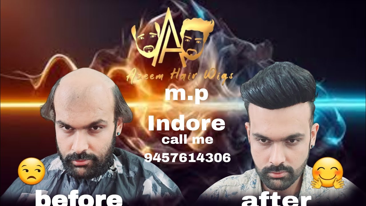 Indore m.p hair patch | hair wigs | non surgical hair replacement centre |