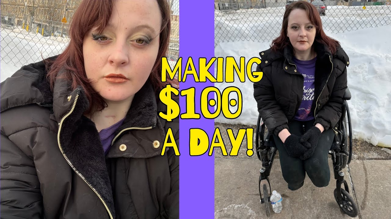 THE DOCTOR PUT MY LEG ON CROOKED! MY DATES HAVE WEIRD FETISHES! 