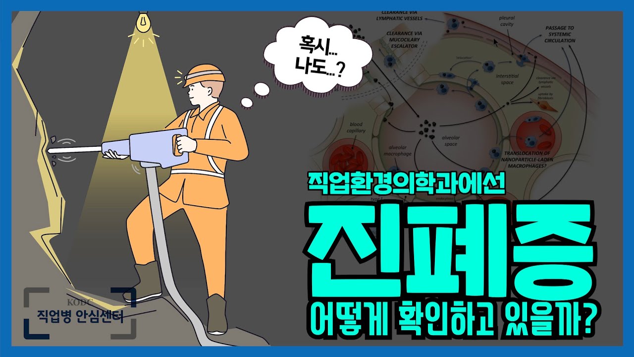 의사라면 알아야 할 직업병 │아직도 사라지지 않은 병 '진폐증' (3/4)
