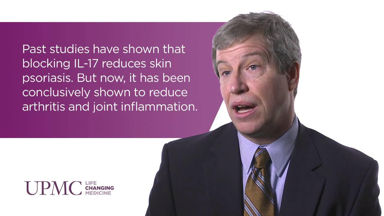 New Therapies for Effectively Treating Psoriatic Arthritis | UPMC