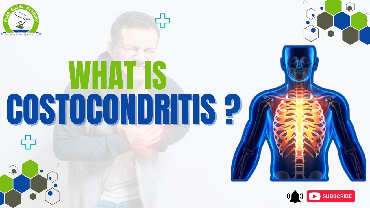 Costochondritis | PLAB GUIDE ACADEMY