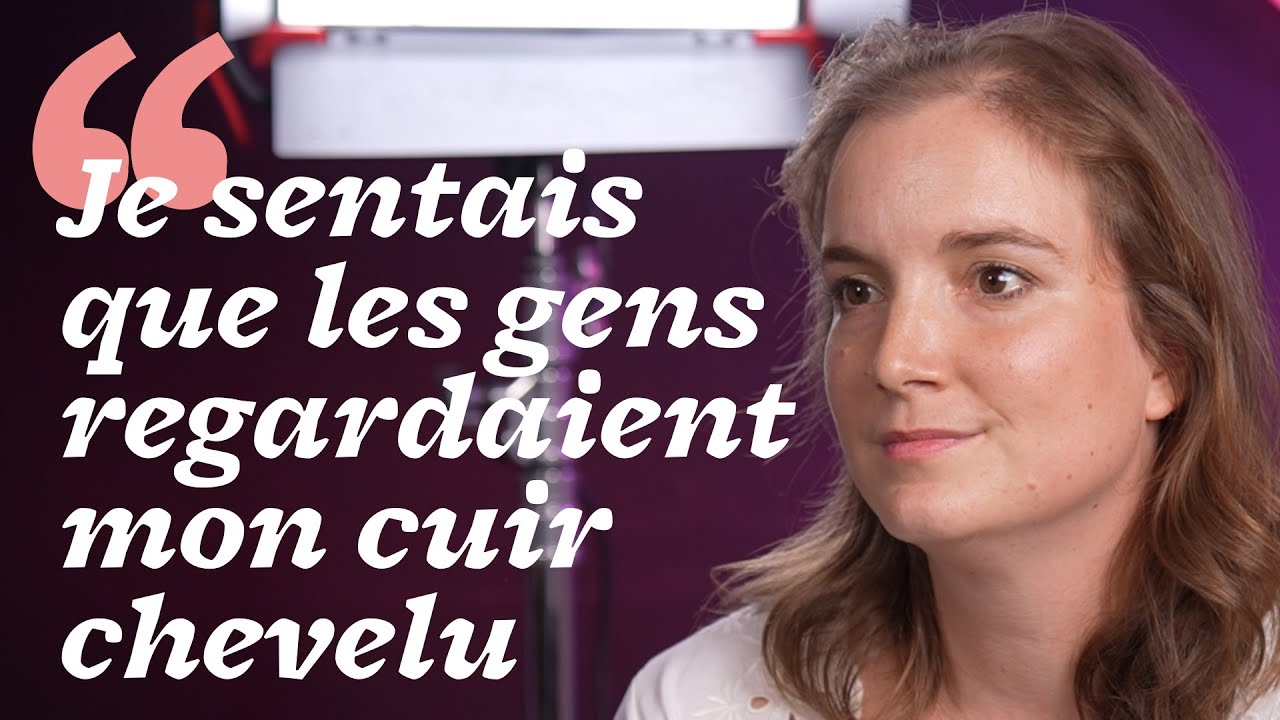 C’est quoi l’alopécie androgénétique ? avec @Comme un diadème