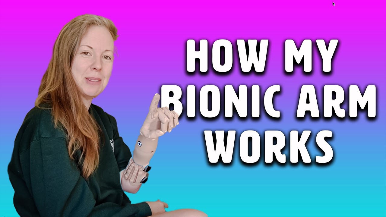 HOW MY BIONIC ARM WORKS! Congenital Amputee uses prosthetic hand
