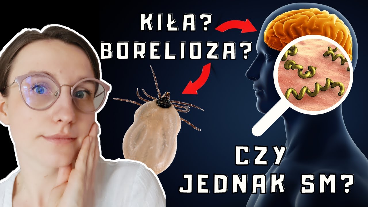 Czy to STWARDNIENIE ROZSIANE? Co daje podobne OBJAWY? Borelioza, kiła? Czy mam SM?  | O, choroba!